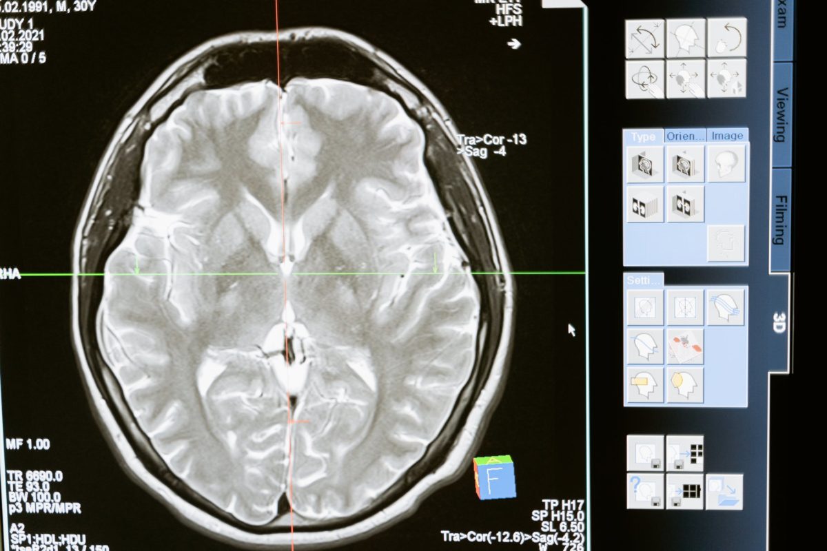 Want to Know How Your Brain Will Be Enhanced in the Future?
